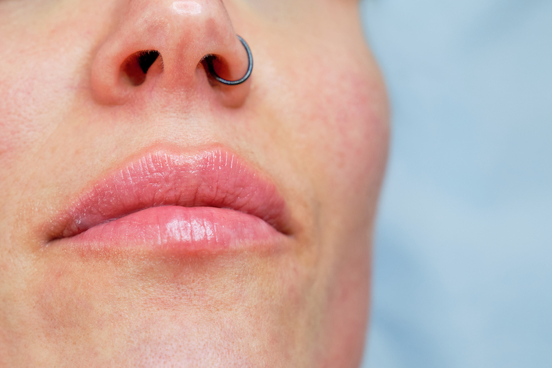 close-up detail of the beautiful lips of a woman recently injected with botulinum toxin with copy space on the right